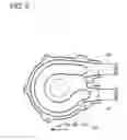 Fig. 06 - VORTEX PUMP