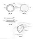 Fig. 08 - Securing assembly