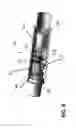 Fig. 09 - Leading thread valve