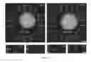Fig. 11 - MIMICRY OF NEUROINFLAMMATORY MICROENVIRONMENTS AND METHODS OF USE AND MANUFACTURING THEREOF