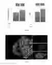 Fig. 13 - MIMICRY OF NEUROINFLAMMATORY MICROENVIRONMENTS AND METHODS OF USE AND MANUFACTURING THEREOF