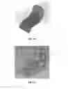 Fig. 08 - Head coil system and methods for enhancing and/or optimizing MRI