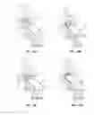 Fig. 09 - Head coil system and methods for enhancing and/or optimizing MRI