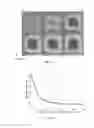 Fig. 11 - Apparatus for improving magnetic resonance imaging