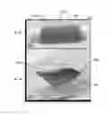 Fig. 15 - Apparatus for improving magnetic resonance imaging