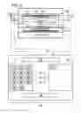 Fig. 04 - Removal of image artifacts in sense-MRI