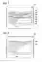 Fig. 08 - Removal of image artifacts in sense-MRI