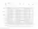 Fig. 01 - Pixel structure and display panel having the same
