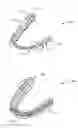 Fig. 01 - Systems and methods for tracking teeth movement during orthodontic treatment