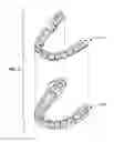 Fig. 03 - Systems and methods for tracking teeth movement during orthodontic treatment