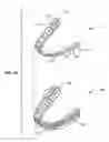Fig. 04 - Systems and methods for tracking teeth movement during orthodontic treatment