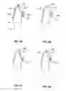 Fig. 07 - Systems and methods for tracking teeth movement during orthodontic treatment