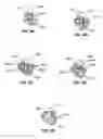 Fig. 10 - Systems and methods for tracking teeth movement during orthodontic treatment