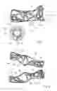 Fig. 02 - Post-traumatic immobilisation device and production method thereof