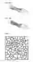 Fig. 07 - Post-traumatic immobilisation device and production method thereof