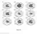 Fig. 05 - Method for identifying personalized therapeutic strategies for patients affected with a cancer