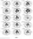 Fig. 06 - Method for identifying personalized therapeutic strategies for patients affected with a cancer