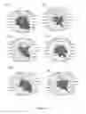 Fig. 12 - Method for identifying personalized therapeutic strategies for patients affected with a cancer