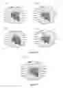 Fig. 13 - Method for identifying personalized therapeutic strategies for patients affected with a cancer