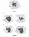 Fig. 14 - Method for identifying personalized therapeutic strategies for patients affected with a cancer