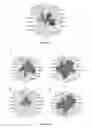 Fig. 17 - Method for identifying personalized therapeutic strategies for patients affected with a cancer
