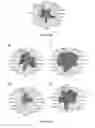 Fig. 20 - Method for identifying personalized therapeutic strategies for patients affected with a cancer