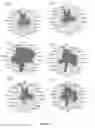 Fig. 24 - Method for identifying personalized therapeutic strategies for patients affected with a cancer