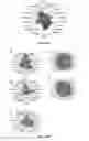 Fig. 30 - Method for identifying personalized therapeutic strategies for patients affected with a cancer