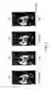 Fig. 06 - Server, electronic device, and method for processing image by electronic device