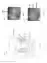 Fig. 09 - Methods and systems for corneal topography, blink detection and laser eye surgery