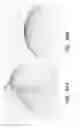 Fig. 40 - Reconstruction of three dimensional model of an object compensating for object orientation changes between surface or slice scans