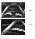 Fig. 41 - Reconstruction of three dimensional model of an object compensating for object orientation changes between surface or slice scans