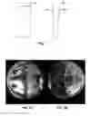 Fig. 02 - Fisheye image stitching for movable cameras