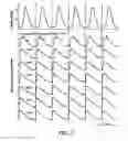 Fig. 07 - Contractile function measuring devices, systems, and methods of use thereof
