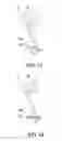 Fig. 05 - Light sensing apparatus having inclined background sheet and light sensing method using the same