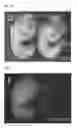 Fig. 03 - Method for producing chimeric animal