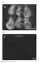 Fig. 14 - Method for producing chimeric animal