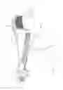 Fig. 06 - LEVERAGE-ENHANCING SUPPORT FOR A FISHING POLE