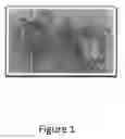 Fig. 02 - System and method for preparing crustacean body parts for meat extraction