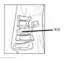 Fig. 01 - METHODS AND APPARATUSES FOR PREPARING SPAGHETTI SQUASH