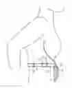Fig. 01 - Drain support apron