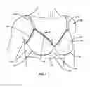 Fig. 02 - Upper and lower torso garments having an improved band