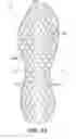 Fig. 33 - Auxetic sole with upper cabling