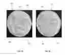 Fig. 02 - COSMETIC PAD AND METHOD FOR ITS MANUFACTURE