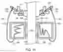 Fig. 08 - TREE NEEDLE CATCHER AND DISPOSAL APPARATUS