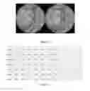 Fig. 09 - Method and system for classifying optic nerve head