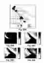 Fig. 26 - Multi-excitation diagnostic system and methods for classification of tissue