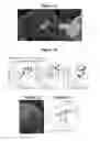 Fig. 02 - Methods for functional brain circuit analysis