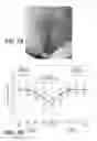 Fig. 11 - APPARATUS AND METHODS FOR DETERMINING DAMAGED TISSUE USING SUB-EPIDERMAL MOISTURE MEASUREMENTS
