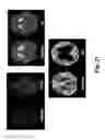 Fig. 22 - Device and method for whole-mind cognitive interface